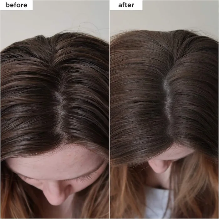 Briogeo Scalp Revival Charcoal + Biotin Dry Shampoo