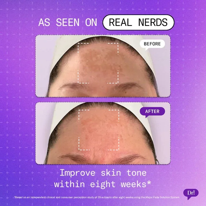 Dr. Idriss Major Fade Hyper Serum Dark Spot + Hyperpigmentation Treatment with Niacinamide and Glycerin