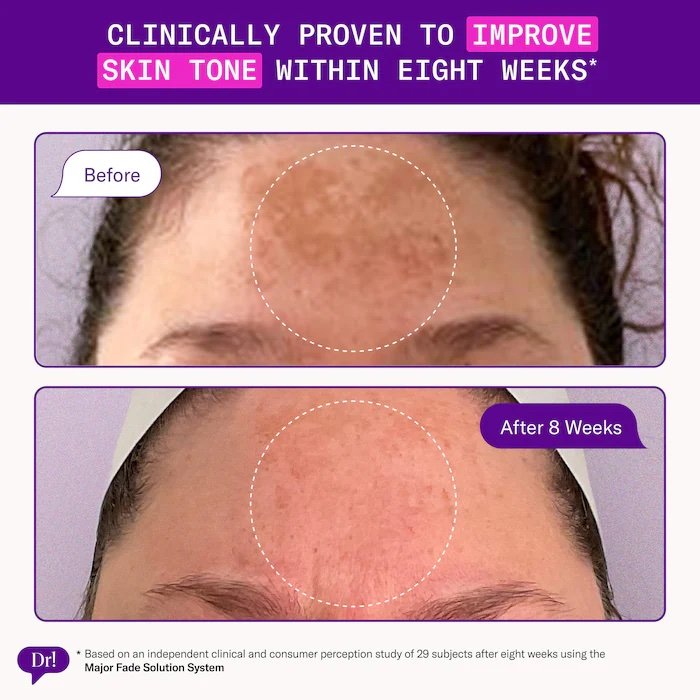 Dr. Idriss Major Fade Dark Spot AHA Face Mask with Glycolic Acid, Panthenol, and Glycerin