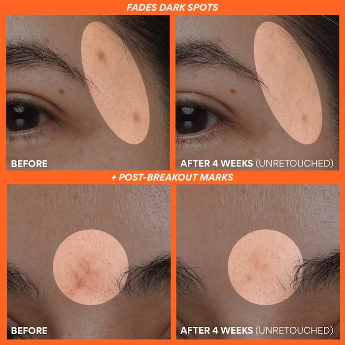 innisfree Rapid Vitamin C Korean Brightening Serum for Dark Spots + Post-Breakout Marks