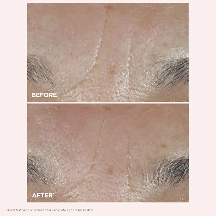 Clarins Total Eye Lift Eye Cream for Firming, Wrinkles, Dark Circles & Puffiness