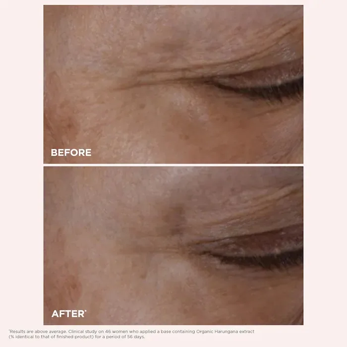 Clarins Total Eye Lift Eye Cream for Firming, Wrinkles, Dark Circles & Puffiness