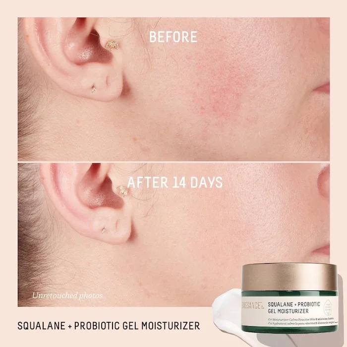 Biossance Probiotic Balancing Gel Moisturizer + Squalane