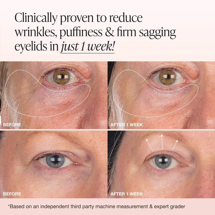 INNBEAUTY Project Extreme Cream Eye Firming & Contouring Refillable Eye Cream
