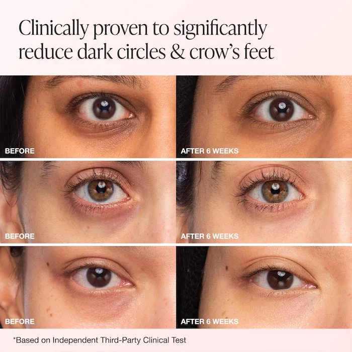 INNBEAUTY Project Bright & Tight Dark Circle Firming Eye Cream with Vitamin C & Peptides