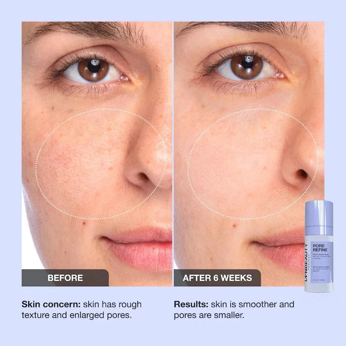 INNBEAUTY Project Pore Refine Pore Shrinking & Texture Smoothing Serum