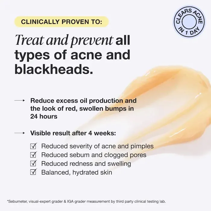 INNBEAUTY Project Acne Serum Medicated Treatment for Acne & Blackheads