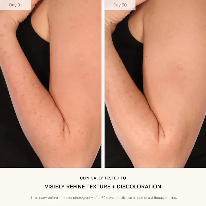 U Beauty Resurfacing Body Compound Body Serum with Glycolic Acid