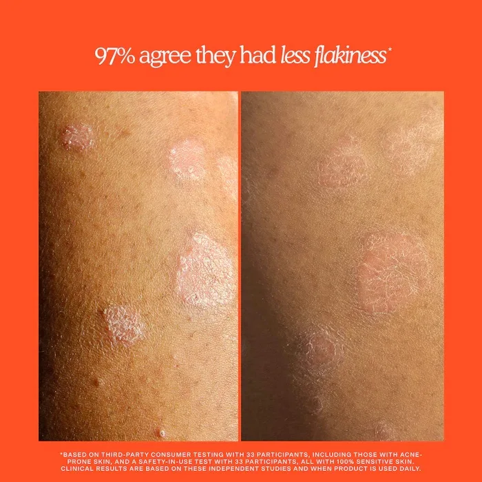 Tower 28 Beauty SOS Rescue + Relief Body Wash Treatment
